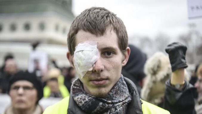 Francuska policja oskarżona o brutalność