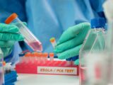 Alarm wirusowy w Sao Paulo: Podejrzenie zakażenia wirusem Ebola